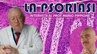 TUTTE LE FACCE DELLA PSORIASI - intervista al Professor Mario Pippione