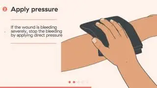 ANIMAL OR HUMAN BITE