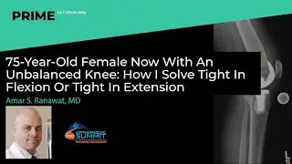 75F Now W/ An Unbalanced Knee: How I Solve Tight In Flexion Or Tight In Extension - Amar Ranawat, MD