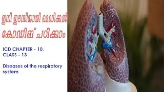 ICD CHAPTER- 10  diseases of respiratory system