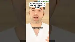 Adi&oacute;s Ojeras Y Bolsas En Los Ojos #medicinanatural #bienestar