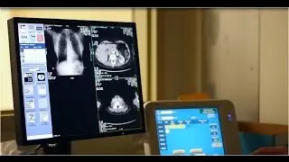 Coronary Calcium Score Screening