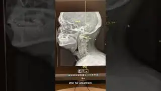 Tinnitus, chronic headaches, vertigo, low back pain, neck pain, and chronic ear fullness