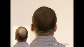 X-tra HAIR Больше объема за секунды, мужчина
