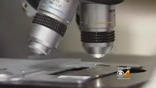 Study: Women Who Use IUD's Have Lower Risk Of Getting Cancer