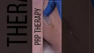 ✨ Stretch Mark Treatment at LYEV Bangladesh | Alma Harmony XL Pro Special Edition ✨