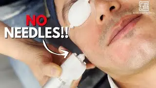한국 최초의 바늘 없는 주사기 | 바늘 없는 리쥬란, 스킨 부스터 & 보톡스!