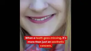 Replacing missing teeth