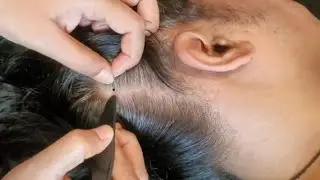 Soothing ASMR Scalp Checking & Tingly Care, (Relax,Focus & Deep Sleep) 💤