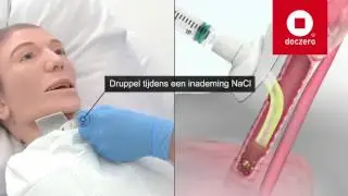 Uitzuigen | Doczero E-learning