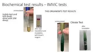 MICRO Bacterial Unknown  Student Training