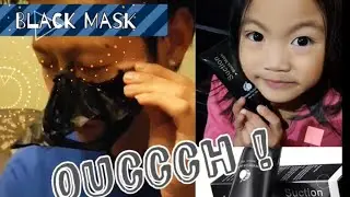 Black Mask Challenge | Blackheads Removal Peeling Mask