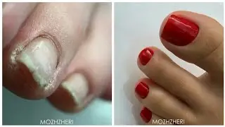 Satisfying pedicure Compilation 2021 | Relaxing Toenails Transformation