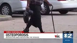 Check Your Health   Identifying and Preventing Osteoporosis