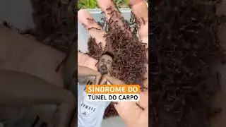 Vc j&aacute; sentiu dorm&ecirc;ncia, formigamento ou dor no punho e na m&atilde;o? Pode ser a S&iacute;ndrome do T&uacute;nel do Carpo