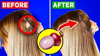 10 Foods That Prevent Hair Loss and Improve Hair Growth
