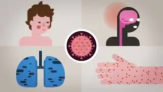 Kurzgesagt In a Nutshell! Measles Explained Vaccinate or Not