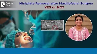 Is it safe to remove Miniplate after Surgery on Face?|Facial Fracture-Dr.Shama Mohan|Doctors' Circle