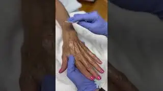Hand Peel Video
