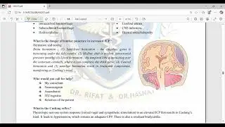 EDH 2 for MRCS B#mrcsbites #mrcsbullets #criticalcare #criticalcare