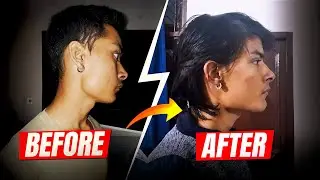Fix Your Recessed Chin in 30 Days, The Ultimate Sharp Jawline Blueprint