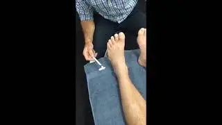 Light Touch Temporal Summation Clinical Testing