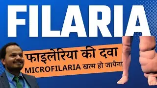 Filaria ki dawa, Treatment of microfilaria, Filariasis ka ilaaz Dr. Pratyush Kumar