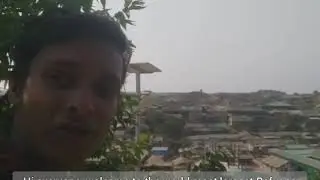 Many Rohingya people facing a hidden difficulty in the Camp.