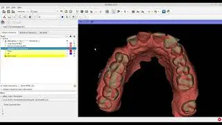 Open-source Software | 3d Slicer | CBCT & Intra Oral Scan Fiducial Registration | 2D Visibility
