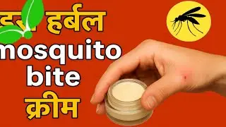 मच्छर काटने से बचने का घरेलु उपाय #mosquitofree #मच्छर #outdooradventure #camping 