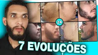 EVOLUÇÕES COM MINOXIDIL - 7 evoluções #24