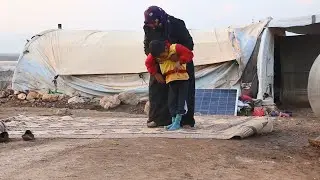 صعوبات تواجه أهالي المصابين بمرض ضمور الدماغ في مخيمات الشمال السوري