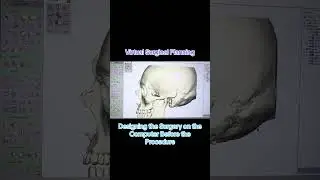 Virtual Surgery Planning (VSP)