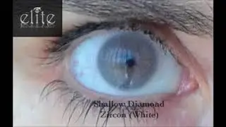 Elite Lenses Zircon
