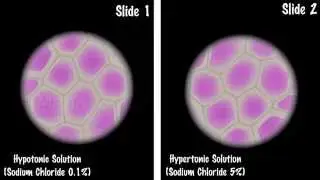 Study of Plasmolysis - MeitY OLabs
