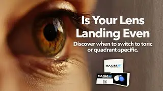 Scleral Lens Fitting: Spherical vs. Toric vs. Quadrant Haptics with Maxim 3D