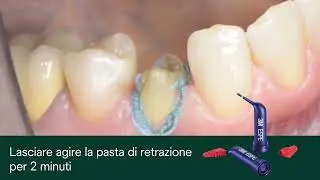 3M Astringent Retraction Paste - Gerh&ograve; Premium Partner