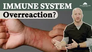 Your Immune System can Overreact - Don't Ignore These Signs!