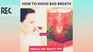 How To Avoid Bad Breath| some ways to get rid of bad breath|