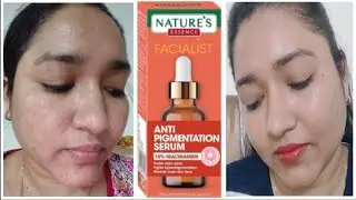 Nature's Essence Facialist Anti Pigmentation Serum Remove Karta Hai 1Week Mein 100%