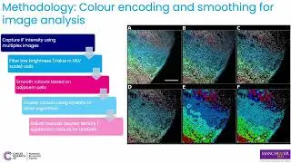 Spatial profiling of small cell lung cancer using lentiviral... - Ian Lee - Poster - ISMB/ECCB 2025