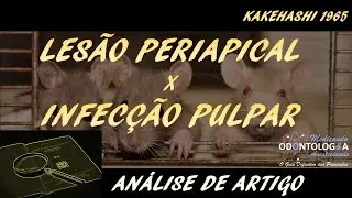 LES&Atilde;O PERIAPICAL x INFEC&Ccedil;&Atilde;O PULPAR: KAKEHASHI 1965 (AN&Aacute;LISE DE ARTIGO)