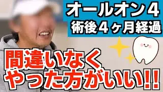 オールオン4（上下）手術後４ヶ月経過！驚きの変化とリアルな感想