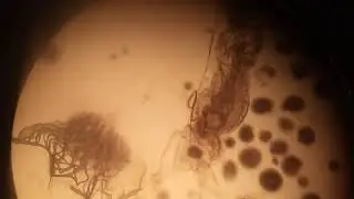 Nematode-infested bursa copulatrix of female Sepsis fulgens (Diptera: Sepsidae)