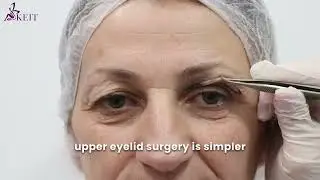 Blepharoplasty Cost: Price Comparison Between the UK, Turkey, and Albania