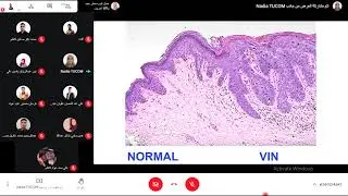 Pathology of genital system/ Lec 1 / Part 1