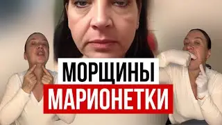 Убираем морщины марионетки. Быстро! 