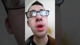 Mālos Pelēkos vardi aprakstā.