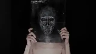 X-Ray - Amazing JIRO