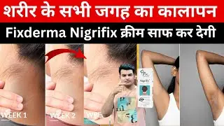 Fixderma Nigrifix Cream Review | Best Cream for Body Pigmentation | Fixderma Nigrifix Cream